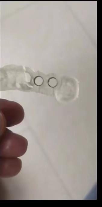 الراتنج الأسنان طابعة ثلاثية ا - مراجعة 3D Printing Uv Resin وسعره